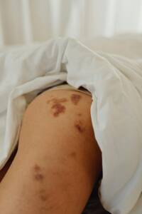 skin-infections-1